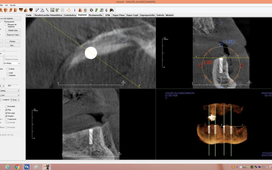 Escáner CBCT 3D en clínica dental en León