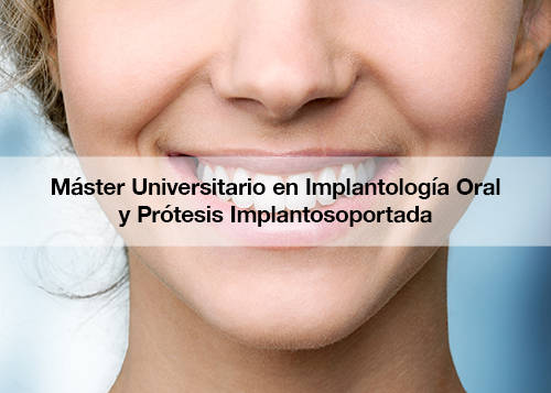 Master Universitario en Implantologia Oral y Protesis Implantosoportada21