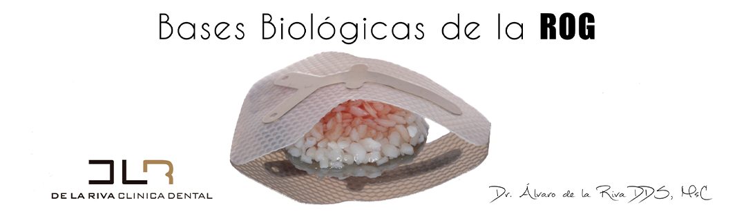 Bases Biologicas de la Regeneracion Osea Guiada5